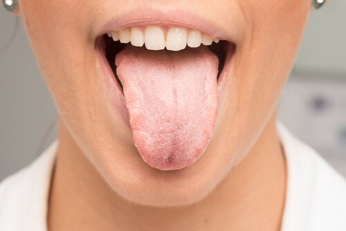 Що є причиною появи білого кольору на язику
