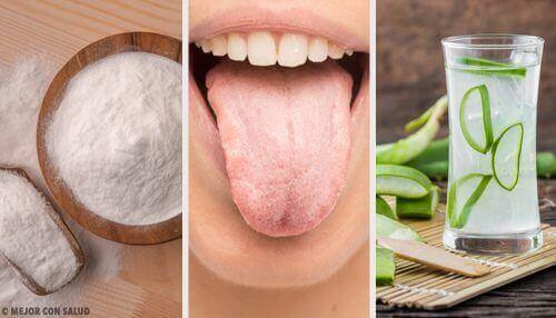 8 натуральних засобів проти білого нальоту на язику