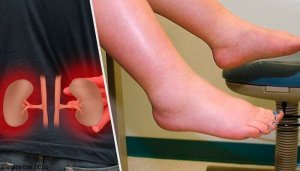 Затримка води: у чому причина?