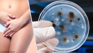 Причини та типи вагінальних інфекцій