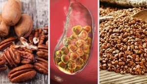 6 продуктів від каменів у жовчному міхурі