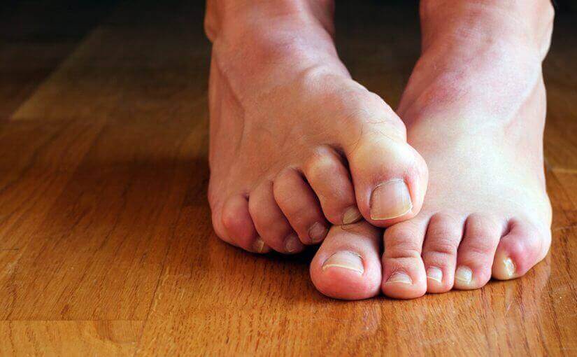 ефективне усунення грибка нігтів