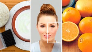 Неймовірні природні способи позбутися шкірних плям