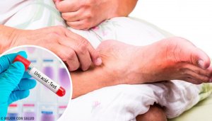 5 причин надлишку сечової кислоти в організмі