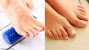 Як усунути ґулі на ступнях без хірургічного втручання