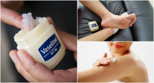 6 способів використання вазеліну з лікувальною метою
