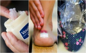 7 способів запобігти появі мозолів на ногах