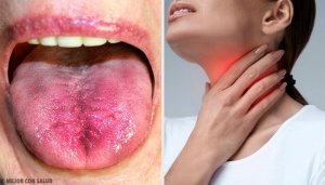 6 способів дізнатися про наліт у горлі
