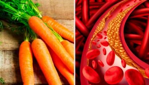 Натуральні та прості засоби для контролю рівня холестерину