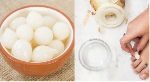 Мозолі на ногах? Позбудьтеся їх за допомогою 100% натуральних засобів