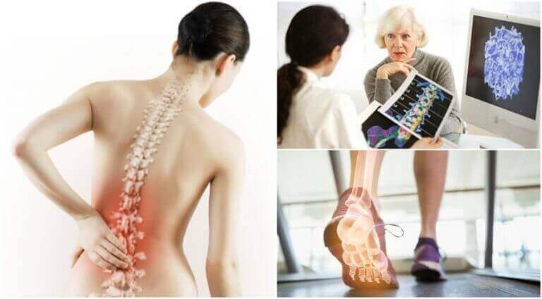 остеопороз викликає біль у спині