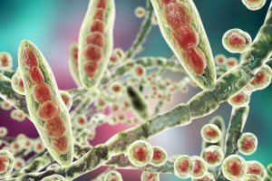 Прості домашні засоби для лікування грибка