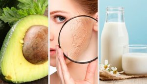 10 найкращих домашніх засобів для зволоження сухої шкіри