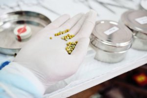 Жовчні камені: корисна дієта, щоб їх позбутися