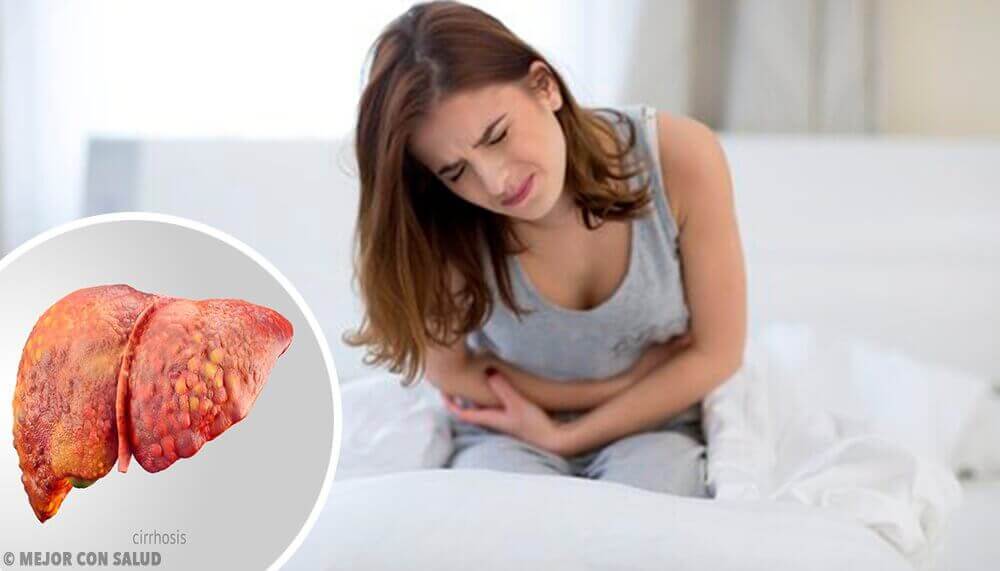 цироз печінки