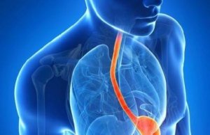 Незвичні симптоми кислотного рефлюксу