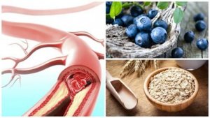 Продукти для зміцнення стінок артерій