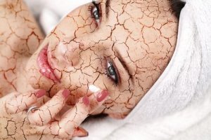 Як зменшити сухість шкіри обличчя