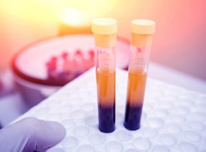 4 засоби для збільшення рівня тромбоцитів