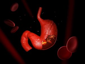 Рослинні засоби від хелікобактерної інфекції