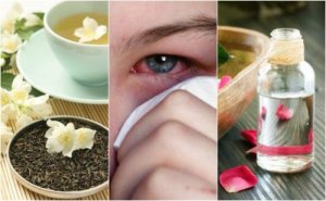 5 натуральних засобів, щоб вилікувати очні інфекції