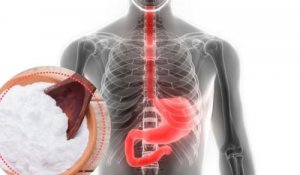 Натуральний засіб від печії з харчовою содою