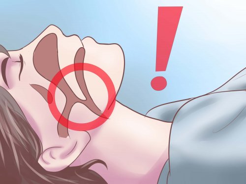 як ефективно лікувати апное сну