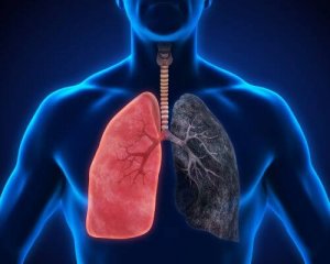 8 симптомів запалення легенів, які не можна ігнорувати