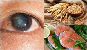 Корисні продукти для профілактики катаракти