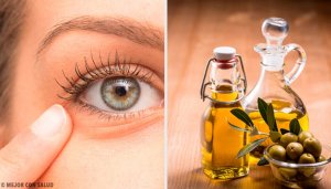 6 натуральних засобів від запалення ока