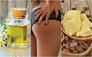 Корисні домашні засоби від розтяжок