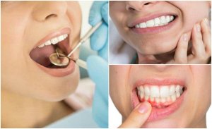 Основні симптоми зубних інфекцій