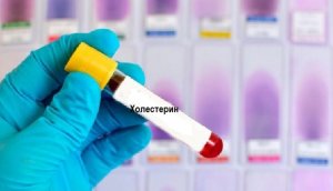 6 трав’яних засобів допоможуть знизити рівень холестерину