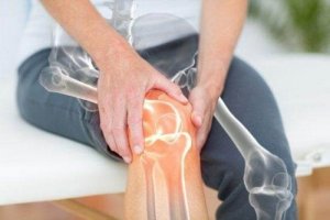 Корисні звички для лікування остеоартриту