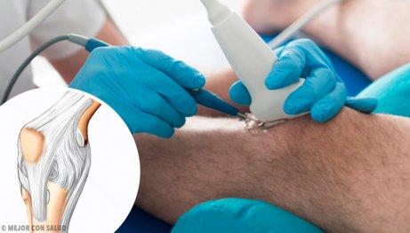 переваги артроскопії коліна