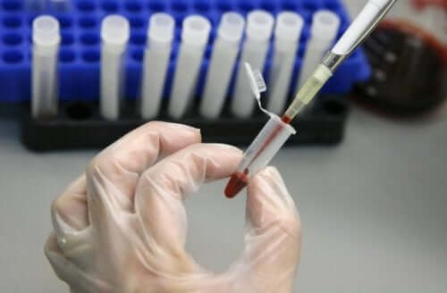 Трансплантація стовбурових клітин може змінити лікування ВІЛ