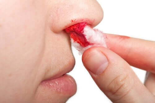 чому трапляються носові кровотечі