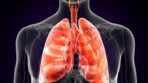 Що таке легенева чума?