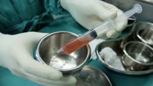 Що таке асцит та як його лікувати