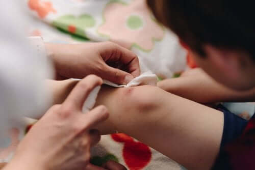 як стимулювати закриття ран