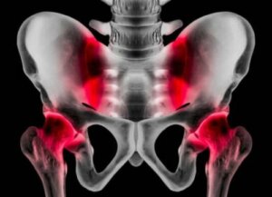 Спортивна грижа: причини, симптоми та лікування