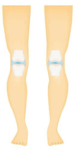 Синовіальні суглоби та їхні типи