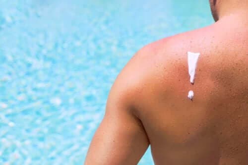 Шкідливий вплив сонячних променів на шкіру