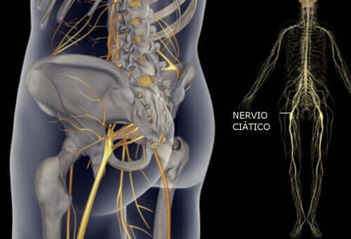 Прості вправи для лікування болю в сідничному нерві