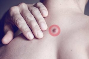 Чому виникають жирові грудочки на спині