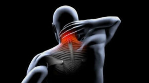 Профілактика м’язової контрактури