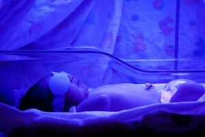 Жовтяниця у новонароджених: що потрібно знати
